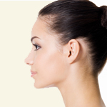 Rhinoplasty