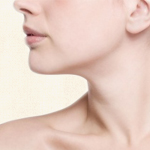 Neck Liposuction